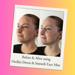 Otella Detox + Soothe Face Mist - Hypochlorous Acid