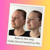 Otella Detox + Soothe Face Mist - Hypochlorous Acid
